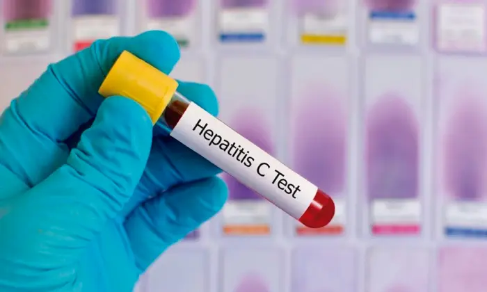 Una enfermedad que afecta a cientos de millones de personas en el mundo